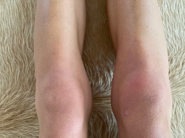 Bild/Image: Hannah Stoll