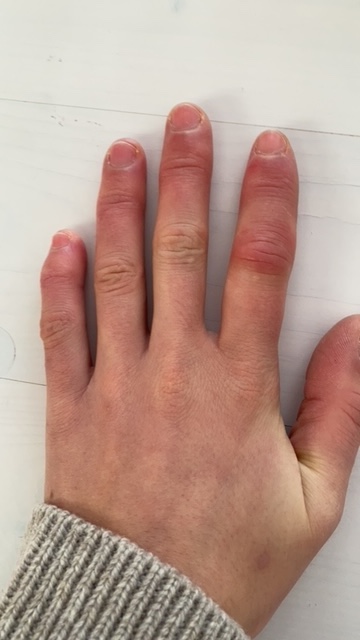 Bild/Image: Hannah Stoll