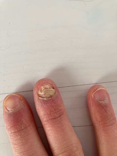 Bild/Image: Hannah Stoll